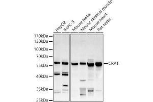 Western blot analysis of extracts of various cell lines, using CRAT antibody (ABIN6131297, ABIN6139003, ABIN6139004 and ABIN6221982) at 1:500 dilution. (CRAT antibody  (AA 357-626))