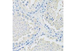 Immunohistochemistry of paraffin-embedded mouse testis using SLC2A9 antibody (ABIN6291466) at dilution of 1:100 (40x lens). (SLC2A9 antibody)