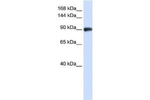 WB Suggested Anti-RAD54B Antibody Titration:  0. (RAD54B antibody  (N-Term))