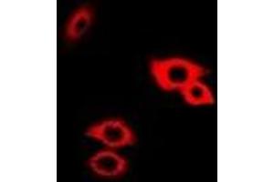Immunofluorescent analysis of Alpha-galactosidase A staining in Hela cells. (GLA antibody)
