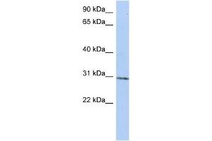 C14ORF172 antibody used at 1 ug/ml to detect target protein. (TRMT61A antibody  (N-Term))