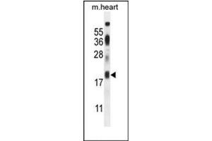 Western blot analysis of ISCA2 / HBLD1 Antibody (Center) in mouse heart tissue lysates (35ug/lane). (ISCA2 antibody  (Middle Region))
