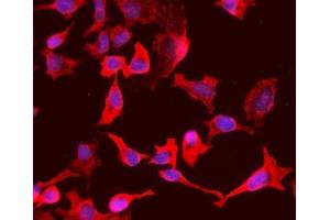 IF analysis of PCK1/PEPC using anti-PCK1/PEPC antibody (ABIN7599502). (PCK1 antibody  (AA 1-622))