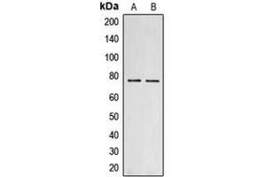 Western blot analysis of Collagen 18 alpha 1 expression in MCF7 (A), PC12 (B) whole cell lysates. (COL18A1 antibody  (C-Term))