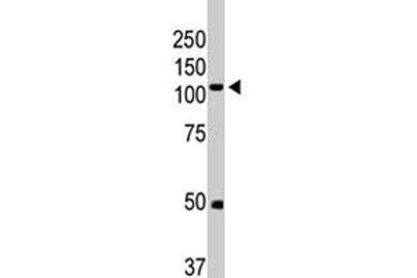 BMPR2 antibody  (AA 28-59)