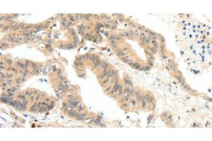 RRAD antibody