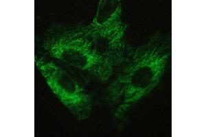 IHC analysis of ATX2 using anti-ATX2 antibody . (Ataxin 2 antibody  (C-Term))