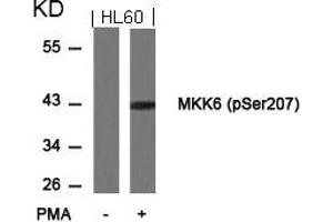 Western blot analysis of extracts from HL60 cells untreated or treated with PMA using MKK6(Phospho-Ser207) Antibody. (MAP2K6 antibody  (pSer207))