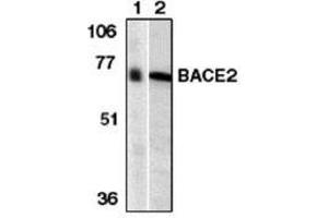 Image no. 1 for anti-beta-Site APP-Cleaving Enzyme 2 (BACE2) (AA 44-59) antibody (ABIN264996) (BACE2 antibody  (AA 44-59))