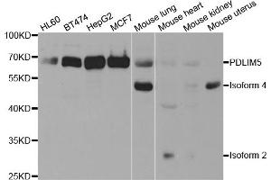 Western blot analysis of extracts of various cell lines, using PDLIM5 antibody (ABIN5973350) at 1/1000 dilution. (PDLIM5 antibody)