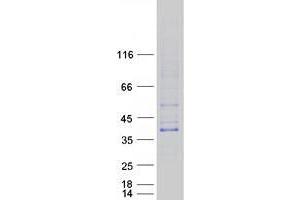 Western Blotting (WB) image for Triggering Receptor Expressed On Myeloid Cells-Like 1 (TREML1) protein (Myc-DYKDDDDK Tag) (ABIN2734202)