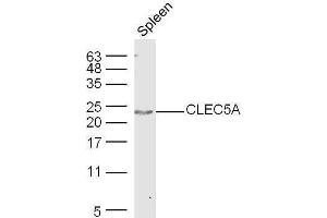 Mouse spleen lysates probed with Rabbit Anti-CLEC5A Polyclonal Antibody, Unconjugated  at 1:500 for 90 min at 37˚C. (CLEC5A antibody  (AA 101-190))