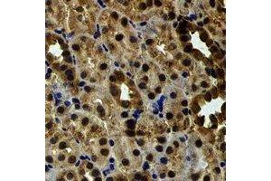 Immunohistochemical analysis of EYA3 staining in rat kidney formalin fixed paraffin embedded tissue section. (EYA3 antibody)