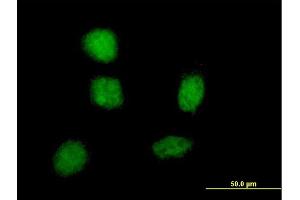 Immunofluorescence of monoclonal antibody to SOX21 on HeLa cell. (SOX21 antibody  (AA 224-265))