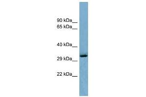 OTUD6B antibody used at 1 ug/ml to detect target protein. (OTUD6B antibody  (Middle Region))