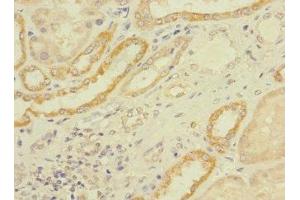Immunohistochemistry of paraffin-embedded human kidney tissue using ABIN7158484 at dilution of 1:100 (LONRF1 antibody  (AA 538-773))
