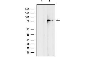 anti-Cylicin, Basic Protein of Sperm Head Cytoskeleton 1 (CYLC1) antibody