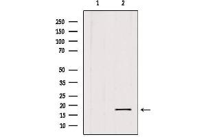 Western blot analysis of extracts from 293, using SKP1 Antibody.