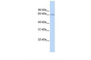 Image no. 1 for anti-Solute Carrier Family 22 Member 6 (SLC22A6) (C-Term) antibody (ABIN6749721) (SLC22A6 antibody  (C-Term))