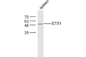 Mouse spleen lysates probed with Rabbit Anti-ETS1 Polyclonal Antibody, Unconjugated  at 1:500 for 90 min at 37˚C.