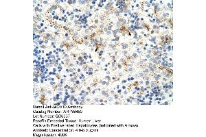 Human Intestine (MOV10 antibody  (C-Term))