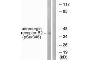 Western blot analysis of extracts from HepG2 cells treated with nocodazole 1ug/ml 16h, using Adrenergic Receptor beta2 (Phospho-Ser346) Antibody. (beta 2 Adrenergic Receptor antibody  (pSer346))