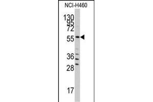 Western blot analysis of anti-SARS Antibody (C-term) (ABIN392296 and ABIN2841952) in NCI- cell line lysates (35 μg/lane). (Seryl-tRNA Synthetase (SARS) (AA 394-422), (C-Term) antibody)
