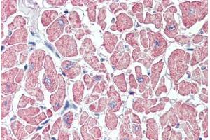 Anti-SLITRK6 antibody  ABIN960816 IHC staining of human heart. (SLITRK6 antibody  (Internal Region))