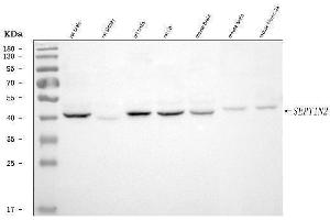Western blot analysis of Septin 2/SEPTIN2 using anti-Septin 2/SEPTIN2 antibody (ABIN7599275).