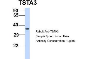 Host: Rabbit Target Name: TSTA3 Sample Type: Hela Antibody Dilution: 1. (TSTA3 antibody  (N-Term))