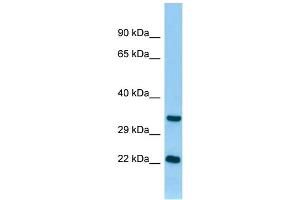 WB Suggested Anti-Tnni3 Antibody Titration: 1.