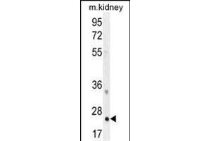 HOXB6 Antibody (Center) (ABIN655657 and ABIN2845130) western blot analysis in mouse kidney tissue lysates (35 μg/lane).