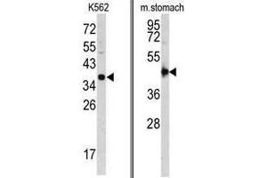 Image no. 1 for anti-Cathepsin E (CTSE) (Middle Region) antibody (ABIN452887) (Cathepsin E antibody  (Middle Region))