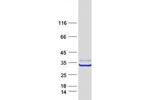 Validation with Western Blot (ABHD11 Protein (Transcript Variant 1) (Myc-DYKDDDDK Tag))