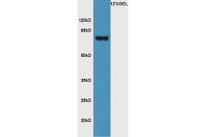 Lane 1: mouse pancreas lysate probed with Rabbit Anti-FZD3/Frizzled 3 Polyclonal Antibody, Unconjugated (ABIN1714171) at 1:300 overnight at 4 °C. (FZD3 antibody  (AA 121-220))