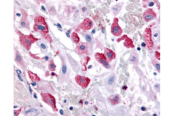 BRS3 antibody  (Cytoplasmic Domain)