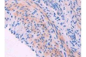 Detection of MYLK in Mouse Oviduct Tissue using Polyclonal Antibody to Myosin Light Chain Kinase (MYLK)