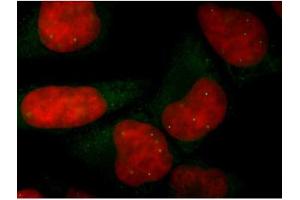 Image no. 2 for anti-Survival of Motor Neuron 1, Telomeric (SMN1) antibody (ABIN108567) (SMN1 antibody)