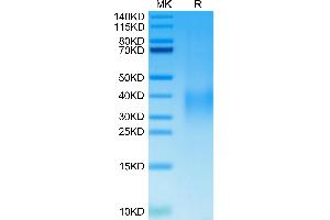 Cynomolgus GPA on Tris-Bis PAGE under reduced condition. (CD235a/GYPA Protein (AA 20-91) (His tag))