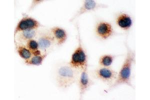 Anti-Bid Picoband antibody,  ICC: A549 Cell (BID antibody  (AA 1-195))