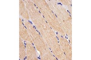 Paraformaldehyde-fixed, paraffin embedded human skeletal muscle, Antigen retrieval by boiling in sodium citrate buffer (pH6. (FES antibody)