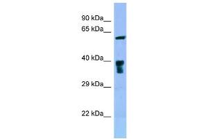 WB Suggested Anti-SLC22A5 Antibody Titration: 1. (SLC22A5 antibody  (C-Term))