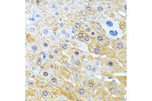 Immunohistochemistry (Paraffin-embedded Sections) (IHC (p)) image for anti-Cyclin D1 (CCND1) (C-Term) antibody (ABIN6138080)