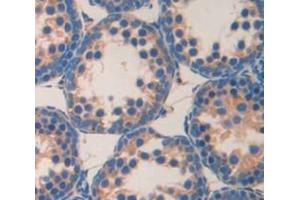 Used in DAB staining on fromalin fixed paraffin- embedded testis tissue (MAST2 antibody  (AA 512-785))