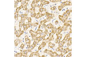 Immunohistochemistry of paraffin-embedded human liver using MDH2 Rabbit mAb (ABIN7268381) at dilution of 1:25 (40x lens).
