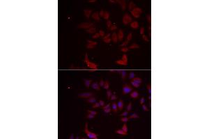 Immunofluorescence analysis of MCF-7 cells using RPL11 antibody. (RPL11 antibody)