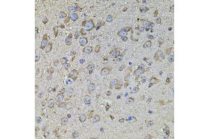 Immunohistochemistry of paraffin-embedded mouse brain using CPOX antibody (ABIN5971997) at dilution of 1/100 (40x lens). (CPOX antibody)