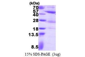 SDS-PAGE (SDS) image for Phosphoglycerate Kinase 2 (PGK2) (AA 1-417) protein (His tag) (ABIN667998)