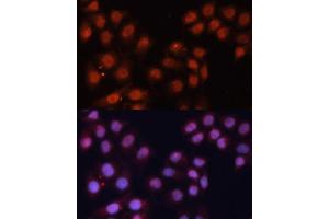Immunofluorescence analysis of HeLa cells using CDK11B antibody (ABIN6130092, ABIN6138305, ABIN6138306 and ABIN6216598) at dilution of 1:100. (CDK11 antibody  (AA 1-130))