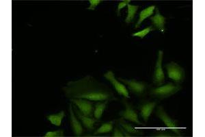 Immunofluorescence of purified MaxPab antibody to CDADC1 on HeLa cell. (CDADC1 antibody  (AA 1-514))